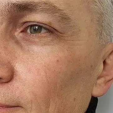 Close-up portrait of middle-aged man's face showing skin texture and facial features in natural lighting.