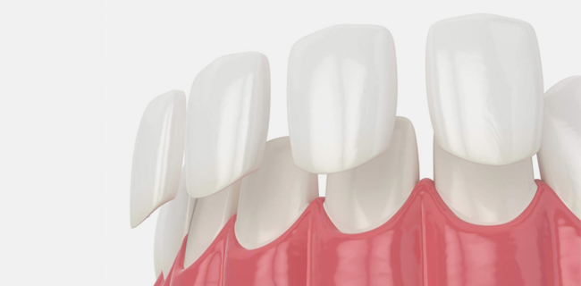White acrylic nails displayed on pink nail tips showing manicure design options.