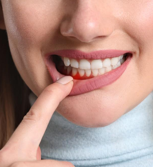 Close-up of person's smiling face displaying bright, white teeth and healthy gums.