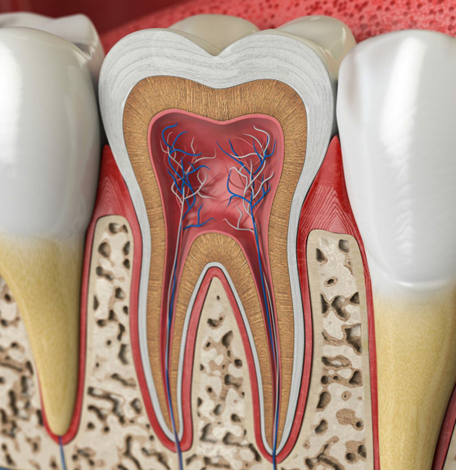 Dental cross-section model showing tooth anatomy with pulp chamber, roots, and surrounding bone structure.