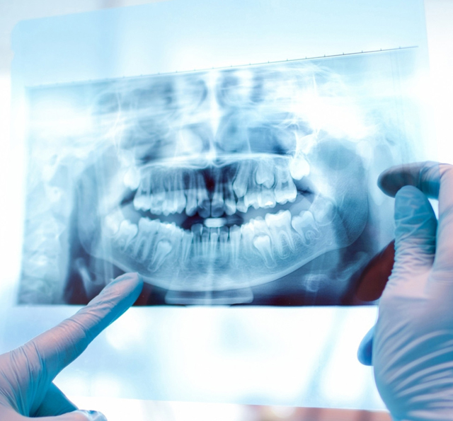 Dentist in gloves examining dental X-ray of patient's teeth and jaw structure.