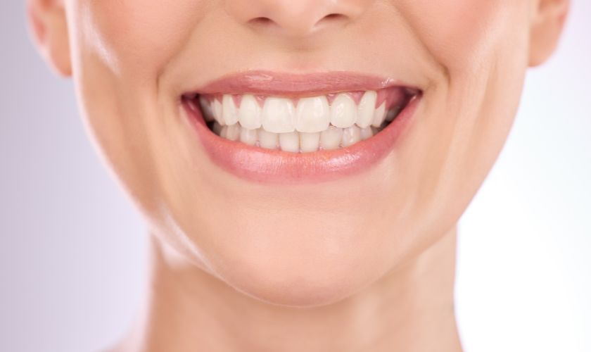 Teeth whitening