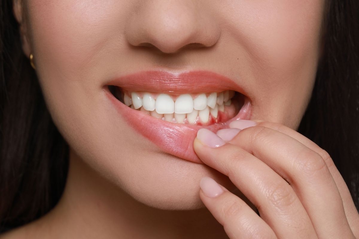 Gum Disease Treatment Marion